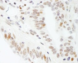 SUPT5H Antibody, Novus Biologicals 0.1mg; Unlabeled:Antibodies, Polyclonal