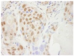 SUPT5H Antibody, Novus Biologicals 0.1mg; Unlabeled:Antibodies, Polyclonal