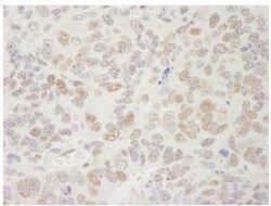 SUPT5H Antibody, Novus Biologicals 0.1mg; Unlabeled:Antibodies, Polyclonal
