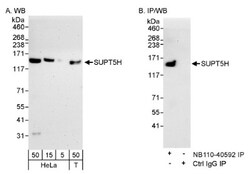 SUPT5H Antibody, Novus Biologicals 0.1mg; Unlabeled:Antibodies, Polyclonal