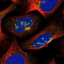 SUR1 Antibody, Novus Biologicals:Antibodies:Primary Antibodies