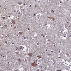 SUR1 Antibody, Novus Biologicals:Antibodies:Primary Antibodies