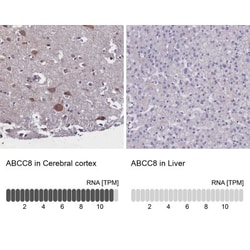 SUR1 Antibody, Novus Biologicals:Antibodies:Primary Antibodies