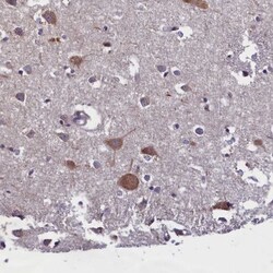 SUR1 Antibody, Novus Biologicals:Antibodies:Primary Antibodies