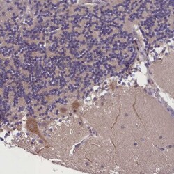 SUR1 Antibody, Novus Biologicals:Antibodies:Primary Antibodies