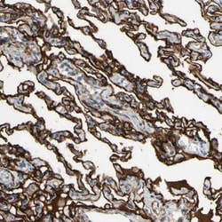 SUSD2 Antibody, Novus Biologicals 25 &mu;L; Unlabeled:Antibodies, Polyclonal