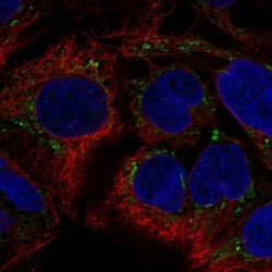 SUV3L1 Antibody, Novus Biologicals:Antibodies:Primary Antibodies
