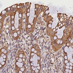 SUV3L1 Antibody, Novus Biologicals:Antibodies:Primary Antibodies