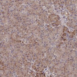 SUV3L1 Antibody, Novus Biologicals:Antibodies:Primary Antibodies