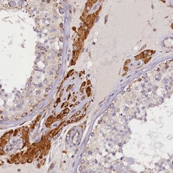 SUV3L1 Antibody, Novus Biologicals:Antibodies:Primary Antibodies