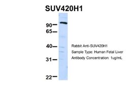 SUV420h1 Antibody, Novus Biologicals 0.05mg; Unlabeled:Antibodies, Polyclonal
