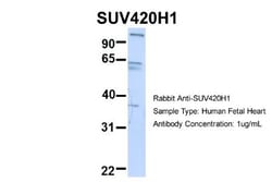 SUV420h1 Antibody, Novus Biologicals 0.05mg; Unlabeled:Antibodies, Polyclonal