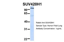 SUV420h1 Antibody, Novus Biologicals 0.05mg; Unlabeled:Antibodies, Polyclonal