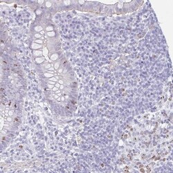 SUZ12 Antibody, Novus Biologicals:Antibodies:Primary Antibodies