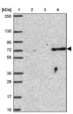 SUZ12 Antibody, Novus Biologicals:Antibodies:Primary Antibodies