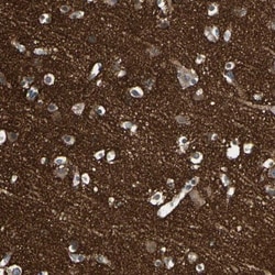 SV2A Antibody, Novus Biologicals 25 &mu;L; Unlabeled:Antibodies, Polyclonal