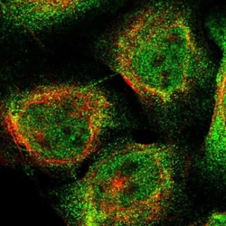 SWT1 Antibody, Novus Biologicals 0.1mL; Unlabeled:Antibodies, Polyclonal