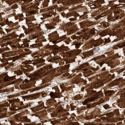SWT1 Antibody, Novus Biologicals 0.1mL; Unlabeled:Antibodies, Polyclonal
