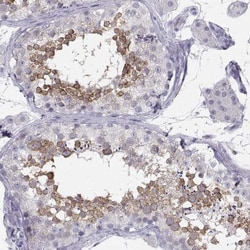 SYCE1 Antibody, Novus Biologicals 25 &mu;L; Unlabeled:Antibodies, Polyclonal