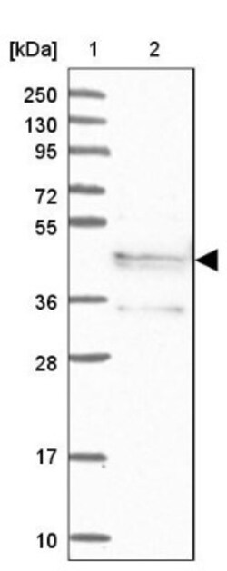 SYCE1 Antibody, Novus Biologicals 25 &mu;L; Unlabeled:Antibodies, Polyclonal