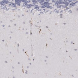 SYK Antibody, Novus Biologicals 0.1mL; Unlabeled:Antibodies, Polyclonal