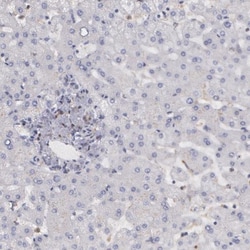 SYK Antibody, Novus Biologicals 0.1mL; Unlabeled:Antibodies, Polyclonal