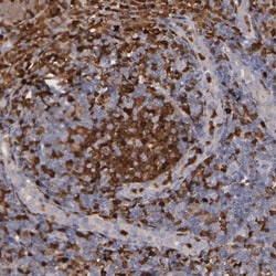 SYK Antibody, Novus Biologicals 0.1mL; Unlabeled:Antibodies, Polyclonal