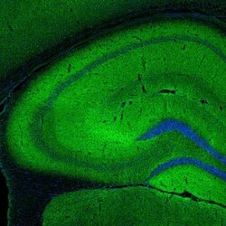 SYNJ2BP/ARIP2 Antibody, Novus Biologicals 25 &mu;L | Buy Online | Novus Biologicals | Fisher Scientific