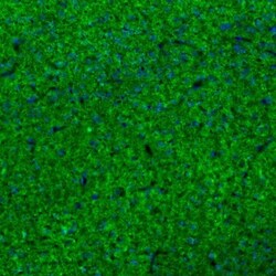 SYNJ2BP/ARIP2 Antibody, Novus Biologicals 25 &mu;L | Buy Online | Novus Biologicals | Fisher Scientific