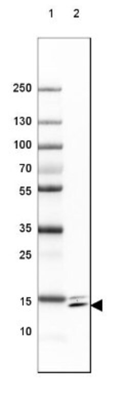 SYNJ2BP/ARIP2 Antibody, Novus Biologicals 25 &mu;L | Buy Online | Novus Biologicals | Fisher Scientific