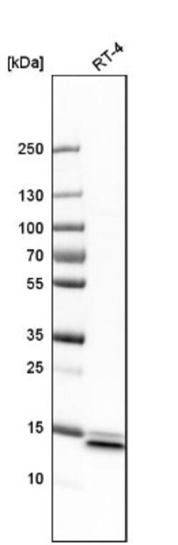 SYNJ2BP/ARIP2 Antibody, Novus Biologicals 25 &mu;L | Buy Online | Novus Biologicals | Fisher Scientific