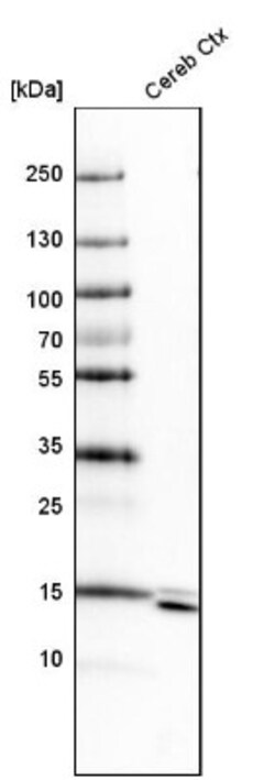 SYNJ2BP/ARIP2 Antibody, Novus Biologicals 25 &mu;L | Buy Online | Novus Biologicals | Fisher Scientific