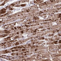 SYNPO2L Antibody, Novus Biologicals 0.1mL; Unlabeled:Antibodies, Polyclonal