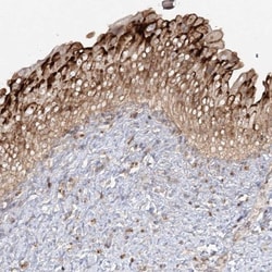 SYTL1 Antibody, Novus Biologicals 0.1mL; Unlabeled:Antibodies, Polyclonal