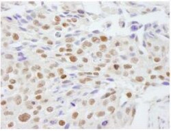 Scaffold attachment factor B2 Antibody, Novus Biologicals 0.1mL; Unlabeled:Antibodies,