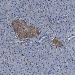 Schlafen 11 Antibody, Novus Biologicals 0.1mL; Unlabeled:Antibodies, Polyclonal