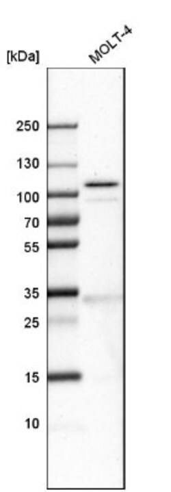 Schlafen 11 Antibody, Novus Biologicals 0.1mL; Unlabeled:Antibodies, Polyclonal
