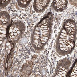 Scribble Antibody, Novus Biologicals 0.1 mL | Buy Online | Novus Biologicals | Fisher Scientific