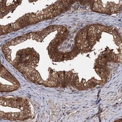 SeP Antibody, Novus Biologicals 25ul | Buy Online | Novus Biologicals | Fisher Scientific