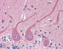 Sec8 Antibody (14G1), Novus Biologicals 0.2 mg; Unconjugated:Antibodies,