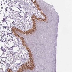 Secretin R Antibody, Novus Biologicals 0.1mL; Unlabeled:Antibodies, Polyclonal