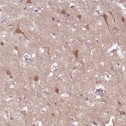 Secretogranin 3 Antibody, Novus Biologicals:Antibodies:Primary Antibodies