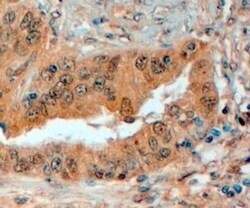 Semaphorin 3E Antibody, Novus Biologicals 0.1mg; Unlabeled:Antibodies,