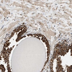 Semaphorin 4D/CD100 Antibody, Novus Biologicals 0.1mL; Unlabeled:Antibodies,