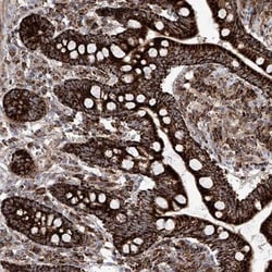 Semaphorin 6A Antibody, Novus Biologicals:Antibodies:Primary Antibodies
