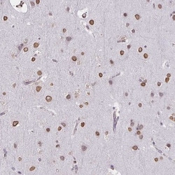 Semaphorin 6B Antibody, Novus Biologicals:Antibodies:Primary Antibodies