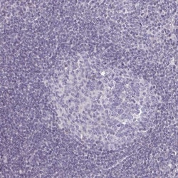 Semaphorin 6B Antibody, Novus Biologicals:Antibodies:Primary Antibodies