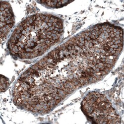Semaphorin 7A Antibody, Novus Biologicals 0.1mL; Unlabeled:Antibodies,