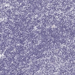 Semenogelin I Antibody, Novus Biologicals:Antibodies:Primary Antibodies