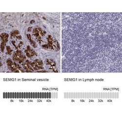 Semenogelin I Antibody, Novus Biologicals:Antibodies:Primary Antibodies